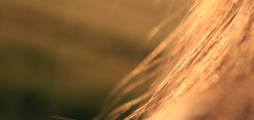 Alopecia