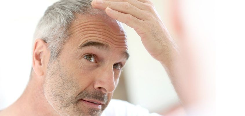 Minoxidil